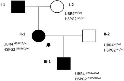 Case report: Episodic ataxia without ataxia?